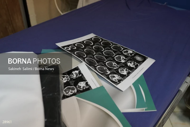 Organ donation surgery in Masih Daneshvari hospital